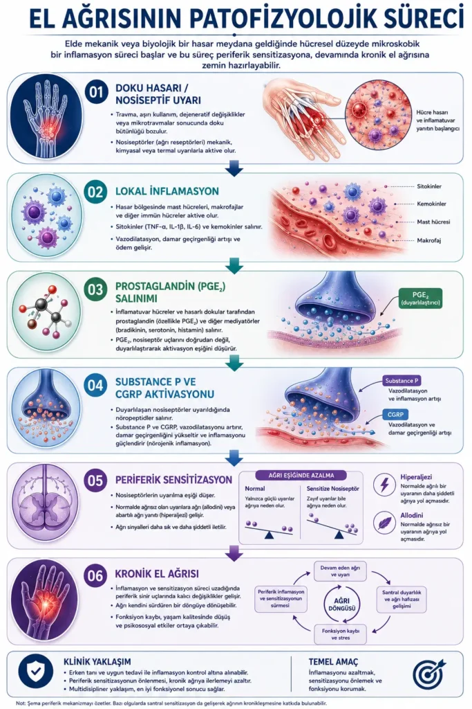 El ağrısının patafizyolojik süreçlerini gösteren tıbbi infografik