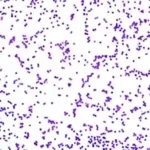 Osteomiyelit etkenlerinden biri olan Staphylococcus aureus bakterisi mikroskop görüntüsü
