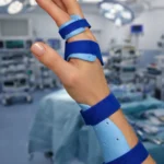 Ekstansör Tendon Yaralanmaları tedavisi Gaziantep El Cerrahisi Kliniği