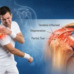 omuz ekleminin ve çevresindeki kasların (Rotator Cuff) anatomik kesiti
