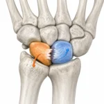 Skafolunat Bağ Yaralanmasına yönelik el bileği anatomisi ve bağ dokusunu gösteren tıbbi görsel.