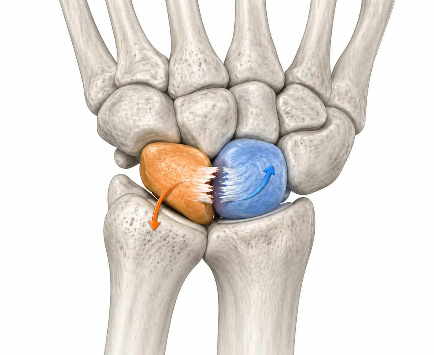 Skafolunat Bağ Yaralanmasına yönelik el bileği anatomisi ve bağ dokusunu gösteren tıbbi görsel.