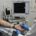Nörofizyoloji laboratuvarında el EMG testi yapılan hastayı ve EMG cihazını gösteren klinik görüntü
