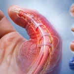 Piyojenik fleksor tenosinovitte tendon kılıfı enfeksiyonu ve Kanavel bulgularını gösteren anatomik medikal illüstrasyon