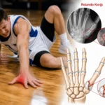 Yere düşen sporcuda başparmak kökünde parçalı Rolando kırığını ve röntgen görünümünü gösteren tıbbi görsel